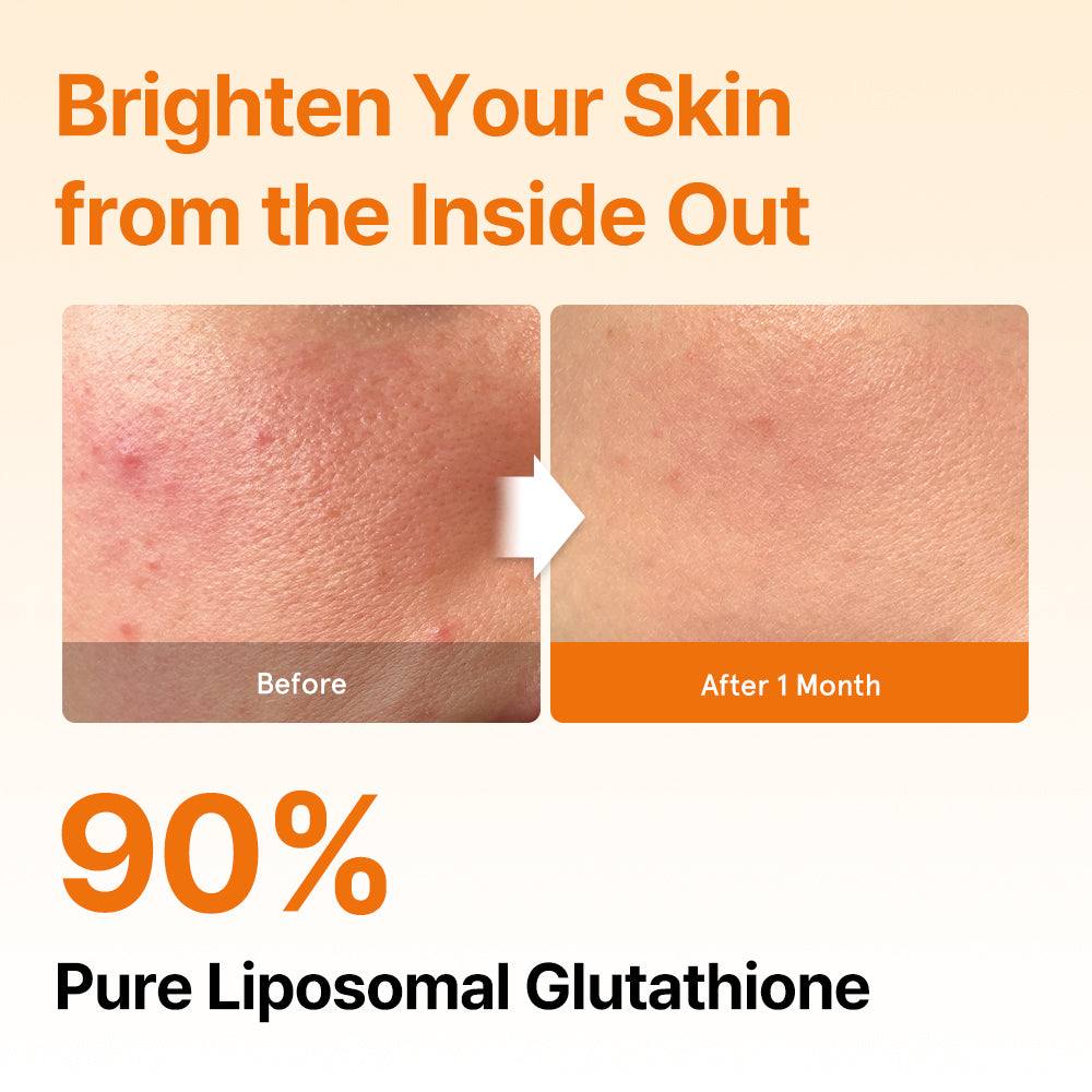 Liposomal Glutathione Direct